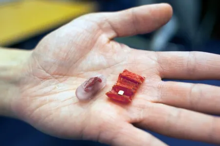 Origami – medyczny robot działający wewnątrz ciała pacjenta