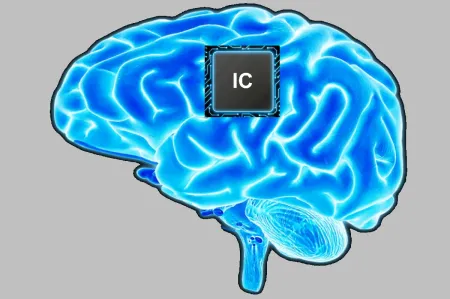 Neuralink - chip w mózgu może sterować komputerem